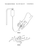 DEVICES AND METHODS FOR SIGNALING WHEN ACTION IS DUE IN RELATION TO A MEDICAL DEVICE diagram and image