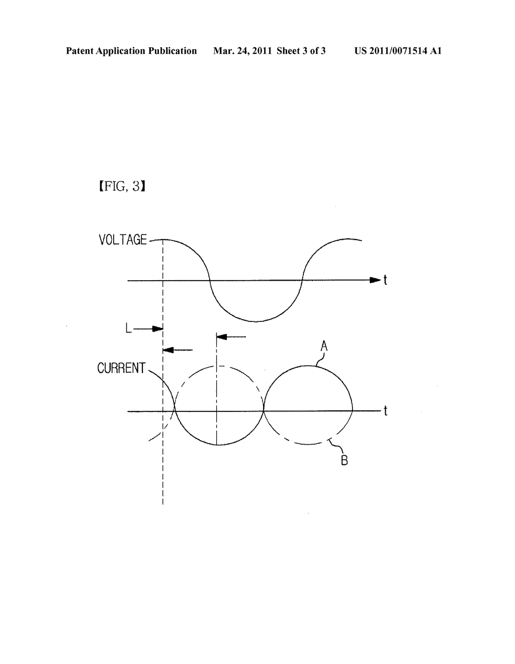 METHOD AND SYSTEM FOR CONTROLLING RADIO FREQUENCY OUTPUT ACCORDING TO CHANGE IN IMPEDANCE OF BIOLOGICAL CELLS - diagram, schematic, and image 04