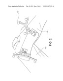 Total knee arthroplasty systems and processes diagram and image