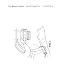 Total knee arthroplasty systems and processes diagram and image