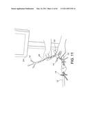 Total knee arthroplasty systems and processes diagram and image