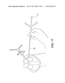 Total knee arthroplasty systems and processes diagram and image