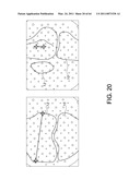 Total knee arthroplasty systems and processes diagram and image