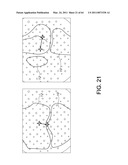 Total knee arthroplasty systems and processes diagram and image