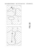 Total knee arthroplasty systems and processes diagram and image