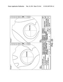 Total knee arthroplasty systems and processes diagram and image