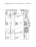 Total knee arthroplasty systems and processes diagram and image