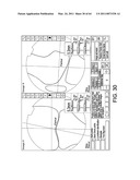 Total knee arthroplasty systems and processes diagram and image