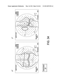 Total knee arthroplasty systems and processes diagram and image