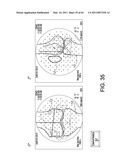 Total knee arthroplasty systems and processes diagram and image