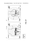 Total knee arthroplasty systems and processes diagram and image