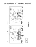 Total knee arthroplasty systems and processes diagram and image