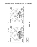 Total knee arthroplasty systems and processes diagram and image