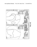 Total knee arthroplasty systems and processes diagram and image