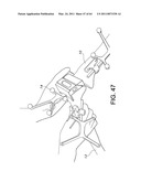 Total knee arthroplasty systems and processes diagram and image