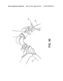 Total knee arthroplasty systems and processes diagram and image