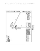 Total knee arthroplasty systems and processes diagram and image