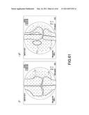 Total knee arthroplasty systems and processes diagram and image