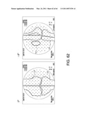 Total knee arthroplasty systems and processes diagram and image