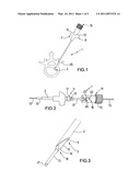 SURGICAL DEVICE diagram and image