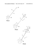 SURGICAL DEVICE diagram and image