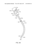 CURVED CANNULA diagram and image