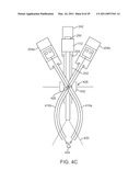 CURVED CANNULA diagram and image