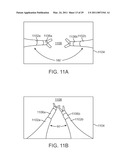 CURVED CANNULA diagram and image