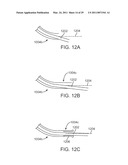 CURVED CANNULA diagram and image