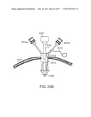 CURVED CANNULA diagram and image