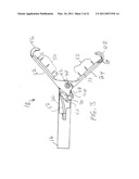 Surgical Clips Particularly Useful in the Endoluminal Treatment of Gastroesophageal Reflux Disease (GERD) diagram and image