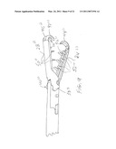 Surgical Clips Particularly Useful in the Endoluminal Treatment of Gastroesophageal Reflux Disease (GERD) diagram and image