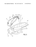 METHODS, DEVICES, KITS AND SYSTEMS FOR DEFUNCTIONALIZING THE CYSTIC DUCT diagram and image