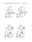 Disposable Orthopaedic Surgery Kit and Components diagram and image