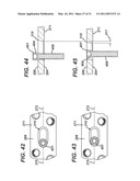 Disposable Orthopaedic Surgery Kit and Components diagram and image