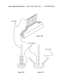 SACRAL NEUROSTIMULATION TO INDUCE MICTURITION IN PARAPLEGICS diagram and image