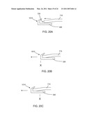 BIFURCATED LEAD SYSTEM AND APPARATUS diagram and image