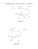 BIFURCATED LEAD SYSTEM AND APPARATUS diagram and image