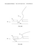 BIFURCATED LEAD SYSTEM AND APPARATUS diagram and image