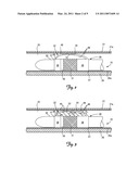 BIASING AND FIXATION FEATURES ON LEADS diagram and image