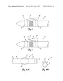 BIASING AND FIXATION FEATURES ON LEADS diagram and image