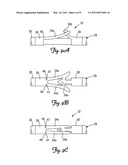 BIASING AND FIXATION FEATURES ON LEADS diagram and image