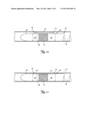 BIASING AND FIXATION FEATURES ON LEADS diagram and image