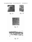 ANTI-ANGIOGENIC COMPOSITIONS AND METHODS OF USE diagram and image