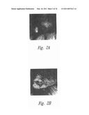 ANTI-ANGIOGENIC COMPOSITIONS AND METHODS OF USE diagram and image