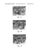 ANTI-ANGIOGENIC COMPOSITIONS AND METHODS OF USE diagram and image