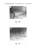 ANTI-ANGIOGENIC COMPOSITIONS AND METHODS OF USE diagram and image