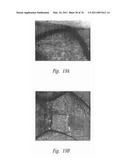 ANTI-ANGIOGENIC COMPOSITIONS AND METHODS OF USE diagram and image