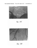 ANTI-ANGIOGENIC COMPOSITIONS AND METHODS OF USE diagram and image