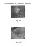 ANTI-ANGIOGENIC COMPOSITIONS AND METHODS OF USE diagram and image